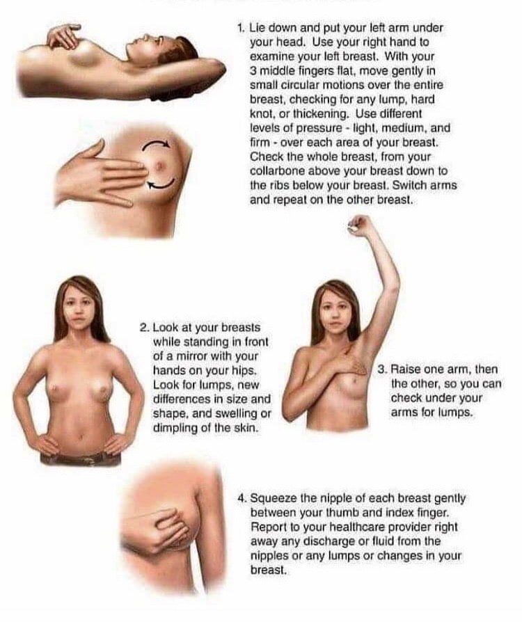 Breast Self-Examination